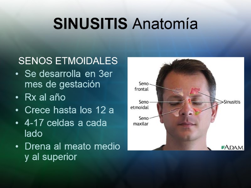 SINUSITIS Anatomía SENOS ETMOIDALES Se desarrolla en 3er mes de gestación Rx al año